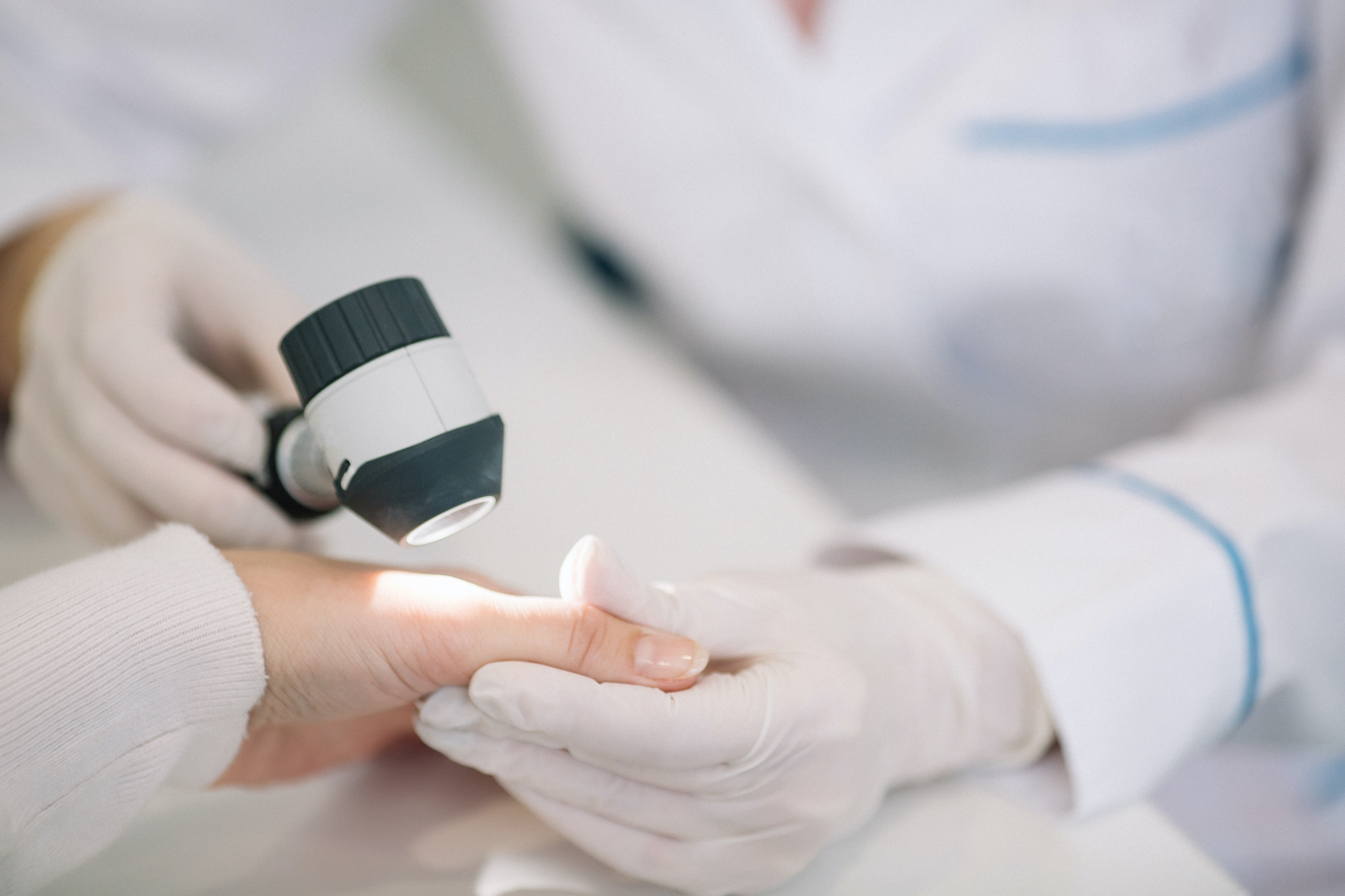 Closeup of dermatologist examining mole on hand of female patient in clinic Closeup of dermatologist examining mole on hand of female patient in clinic