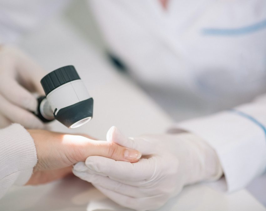 Closeup of dermatologist examining mole on hand of female patient in clinic Closeup of dermatologist examining mole on hand of female patient in clinic